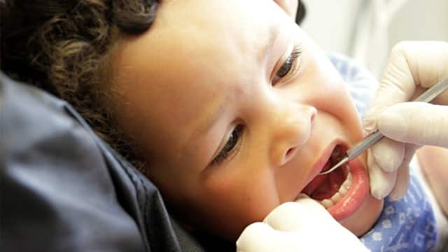 Cuál es la edad recomendada para llevar a mi hijo al dentist